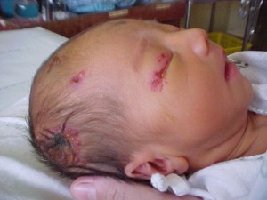 poor baby