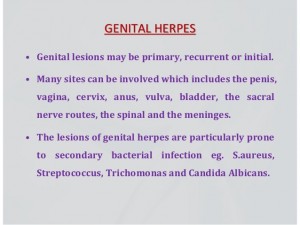 genital herpes
