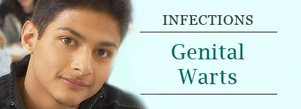 GW