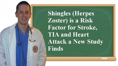 shingles and stroke